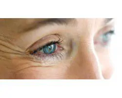 Göz çevresi kırışıklık (kaz ayağı) krem/serum